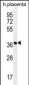 OR5AS1 Antibody (C-term)